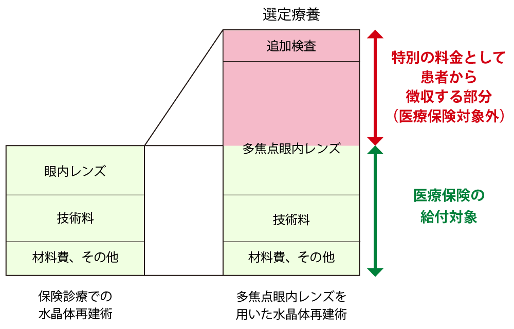 当院では多焦点眼内レンズを用いた白内障手術を行っております。