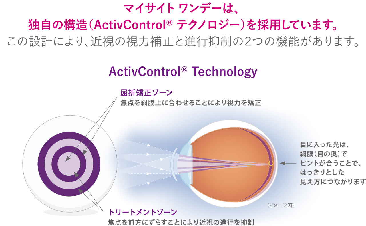 マイサイトワンデーは独自の構造を採用しています。