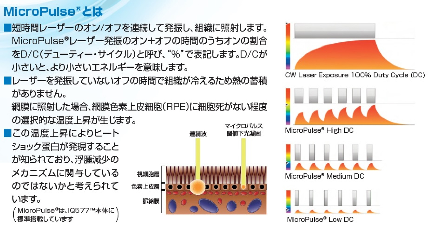 MicroPulseとは